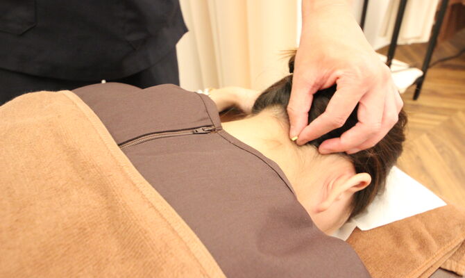 松戸市の接骨院鍼灸院で頭痛の鍼灸をしている様子